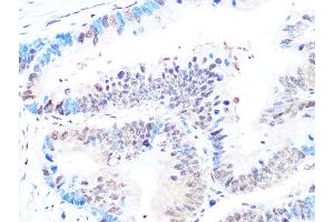 Immunohistochemistry (IHC) image for anti-Casein Kinase 2, beta (CSNK2B) antibody (ABIN1680593)