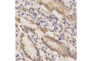 Immunohistochemistry of paraffin-embedded human stomach using TAPBP Antibody. (TAPBP antibody)