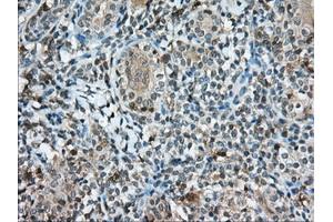Immunohistochemical staining of paraffin-embedded Human Kidney tissue using anti-CD5 mouse monoclonal antibody. (CD5 antibody)