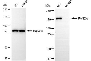 Western blotting analysis using FANCA antibody (ABIN7798563). (Recombinant FANCA antibody)