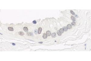 anti-Germ Cell Associated 2 (Haspin) (GSG2) (AA 300-350) antibody
