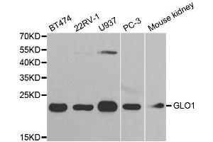 Western blot analysis of extracts of various cell lines, using GLO1 antibody. (GLO1 antibody  (AA 1-184))
