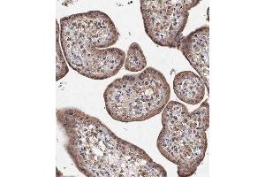 Immunohistochemistry (Paraffin-embedded Sections) (IHC (p)) image for anti-Bromodomain Containing 9 (BRD9) (AA 3-29), (N-Term) antibody (ABIN1538876)