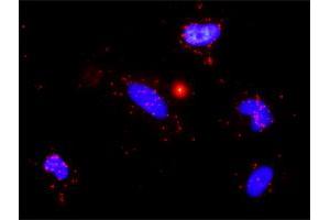 Proximity Ligation Analysis of protein-protein interactions between TGFB1 and MMP9. (MMP 9 antibody  (AA 1-707))