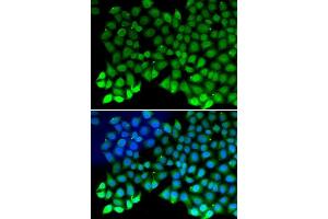 Immunofluorescence analysis of MCF7 cell using RPA1 antibody. (RPA1 antibody  (AA 367-616))