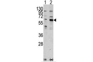 Western blot analysis of PAK3 antibody and 293 cell lysate either nontransfected (Lane 1) or transiently transfected with the PAK3 gene (2). (PAK3 antibody  (AA 218-247))