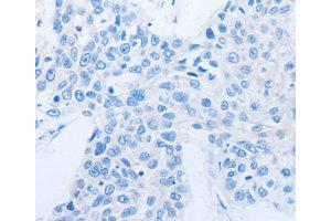 Immunohistochemistry (IHC) image for anti-Neurotrophin 3 (NTF3) antibody (ABIN1873967) (Neurotrophin 3 antibody)