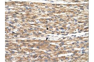 PNPLA3 antibody was used for immunohistochemistry at a concentration of 4-8 ug/ml. (PNPLA3 antibody  (C-Term))