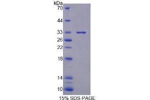 SDS-PAGE analysis of Mouse XYLT1 Protein.