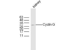 Mouse kidney lysates probed with Rabbit Anti-Cyclin G Polyclonal Antibody, Unconjugated  at 1:300 overnight at 4˚C.