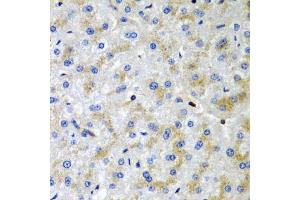 Immunohistochemistry of paraffin-embedded human liver damage using SRGN antibody (ABIN6132571, ABIN6148441, ABIN6148443 and ABIN6222700) at dilution of 1:200 (40x lens). (SRGN antibody  (AA 28-158))