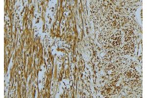ABIN6268668 at 1/100 staining Mouse muscle tissue by IHC-P. (Vinculin antibody  (N-Term))