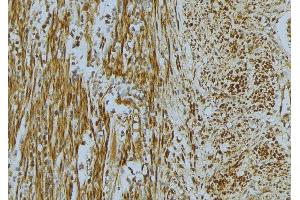 Immunohistochemistry (IHC) image for anti-Vinculin (VCL) (N-Term) antibody (ABIN6265986)