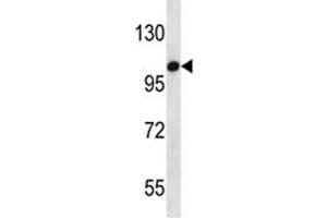 TLR7 antibody western blot analysis in HepG2 lysate (TLR7 antibody  (AA 899-926))