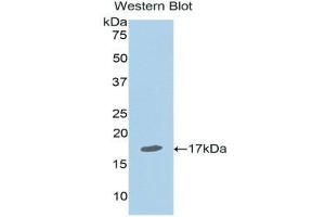 Western Blotting (WB) image for anti-Nuclear Receptor Subfamily 3, Group C, Member 1 (Glucocorticoid Receptor) (NR3C1) (AA 41-184) antibody (ABIN1174819) (Glucocorticoid Receptor antibody  (AA 41-184))