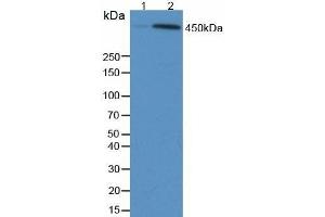 Detection of TP53BP1 in Human 293 Cells using Anti-Phosphorylated Tumor Protein p53 Binding Protein 1 (TP53BP1) Monoclonal Antibody (TP53BP1 antibody  (pSer1778))