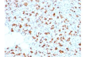 Formalin-fixed, paraffin-embedded human Pancreas stained with BARX1 Mouse Monoclonal Antibody (BARX1/2759). (BARX1 antibody  (AA 155-254))