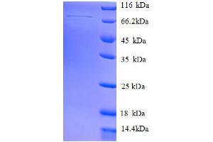 SDS-PAGE (SDS) image for Heat Shock Protein 70kDa Family, Member 13 (HSPA13) (AA 23-471), (full length) protein (GST tag) (ABIN1095626)