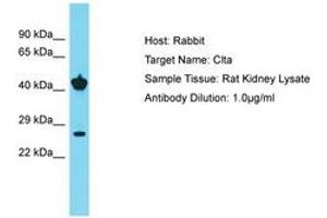 Image no. 1 for anti-Clathrin, Light Chain A/B (CLTA/CLTB) (C-Term) antibody (ABIN6750433)