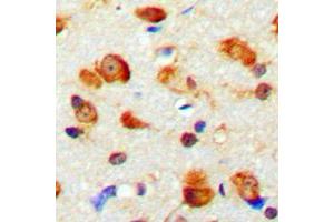 Immunohistochemical analysis of MYO1D staining in human brain formalin fixed paraffin embedded tissue section. (Myosin ID antibody  (C-Term))