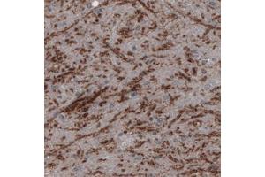 Immunohistochemical staining (Formalin-fixed paraffin-embedded sections) of human substantia nigra pars reticulata with SLC32A1 monoclonal antibody, clone CL2793  shows positivity in GABAergic neural fibers.
