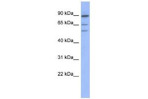 WB Suggested Anti-TRIM50 Antibody Titration:  0. (TRIM50 antibody  (Middle Region))