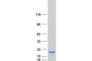 Western Blotting (WB) image for Ubiquitin-Conjugating Enzyme E2 Variant 1 (UBE2V1) (Transcript Variant 4) protein (Myc-DYKDDDDK Tag) (ABIN2734875)