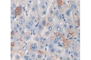 #VALUE! (PZP antibody  (AA 1246-1495))