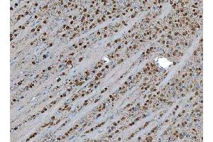 IHC analysis of TSR2 using anti-TSR2 antibody (ABIN7599035).