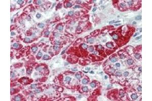 Immunohistochemistry (IHC) image for anti-Transient Receptor Potential Cation Channel, Subfamily C, Member 6 (TRPC6) (C-Term) antibody (ABIN400824) (TRPC6 antibody  (C-Term))
