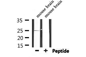 Western blot analysis of extracts from mouse brain, using PRDX6 Antibody. (Peroxiredoxin 6 antibody  (Internal Region))