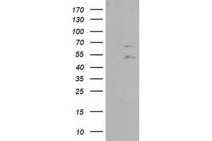 HEK293T cells were transfected with the pCMV6-ENTRY control (Left lane) or pCMV6-ENTRY PTPN11 (Right lane) cDNA for 48 hrs and lysed. (PTPN11 antibody)