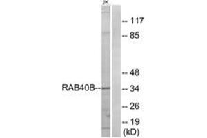 Western blot analysis of extracts from Jurkat cells, using RAB40B Antibody. (RAB40B antibody  (AA 229-278))