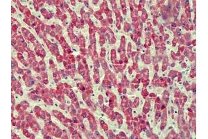 Human Liver: Formalin-Fixed, Paraffin-Embedded (FFPE) (ANTXR2 antibody)