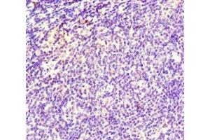 Immunohistochemistry of paraffin-embedded human lymph node tissue using ABIN7171353 at dilution of 1:100 (TCL1A antibody  (AA 1-90))