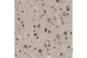 Immunohistochemical staining (Formalin-fixed paraffin-embedded sections) of human cerebral cortex using KAT5 polyclonal antibody  shows strong nuclear positivity in neurons. (KAT5 antibody  (AA 150-286))
