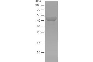 Western Blotting (WB) image for Actinin, alpha 1 (ACTN1) (AA 272-490) protein (His-IF2DI Tag) (ABIN7121663) (ACTN1 Protein (AA 272-490) (His-IF2DI Tag))