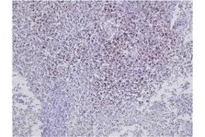 Immunohistochemistry (IHC) image for anti-CD8 (CD8) antibody (ABIN1449140)