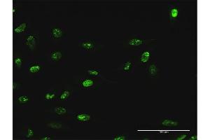 Immunofluorescence of purified MaxPab antibody to WDR18 on HeLa cell. (WDR18 antibody  (AA 1-432))