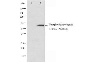 Western blot analysis of Synaptotagmin phosphorylation expression in Forskolin treated 293 whole cell lysates,The lane on the left is treated with the antigen-specific peptide. (Synaptotagmin antibody  (pThr202))