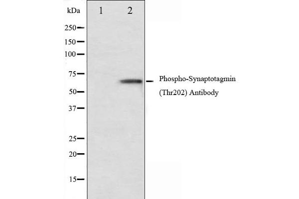 Synaptotagmin antibody  (pThr202)