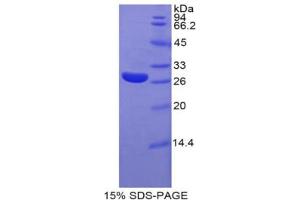 SDS-PAGE analysis of Rat Glypican 4 Protein. (GPC4 Protein)