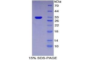 SDS-PAGE analysis of Rat IFNa/bR1 Protein. (IFNAR1 Protein)