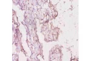 Immunohistochemistry of paraffin-embedded human placenta tissue using ABIN7158439 at dilution of 1:20 (LRBA antibody  (AA 2-252))