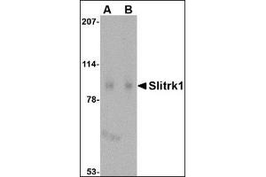 Western blot analysis of Slitrk1 in human brain tissue lysate with this product at (A) 1 and (B) 2 μg/ml. (SLITRK1 antibody  (C-Term))