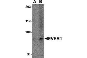 Western Blotting (WB) image for anti-Transmembrane Channel-Like 6 (TMC6) (N-Term) antibody (ABIN1031375) (TMC6 antibody  (N-Term))