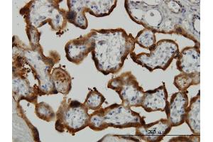 Immunoperoxidase of monoclonal antibody to TGM2 on formalin-fixed paraffin-embedded human placenta. (Transglutaminase 2 antibody  (AA 1-120))