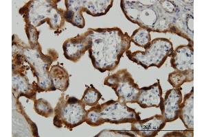 Immunoperoxidase of monoclonal antibody to TGM2 on formalin-fixed paraffin-embedded human placenta. (Transglutaminase 2 antibody  (AA 1-120))