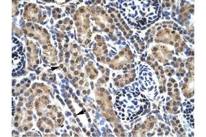 PHKG2 antibody was used for immunohistochemistry at a concentration of 4-8 ug/ml to stain Epithelial cells of renal tubule (Indicated with Arrows) in Human kidney. (PHKG2 antibody)