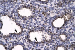 Image no. 1 for anti-High Mobility Group Box 2 (HMGB2) (C-Term) antibody (ABIN6735776) (HMGB2 antibody  (C-Term))